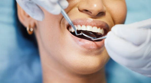 Best Broken or Chipped Tooth Repair in Lasalle, IL